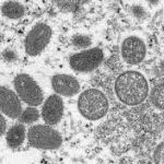 Como os Estados Unidos conseguiram diminuir os casos de mpox ?