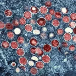 Mpox não é mais uma emergência sanitária global, diz OMS